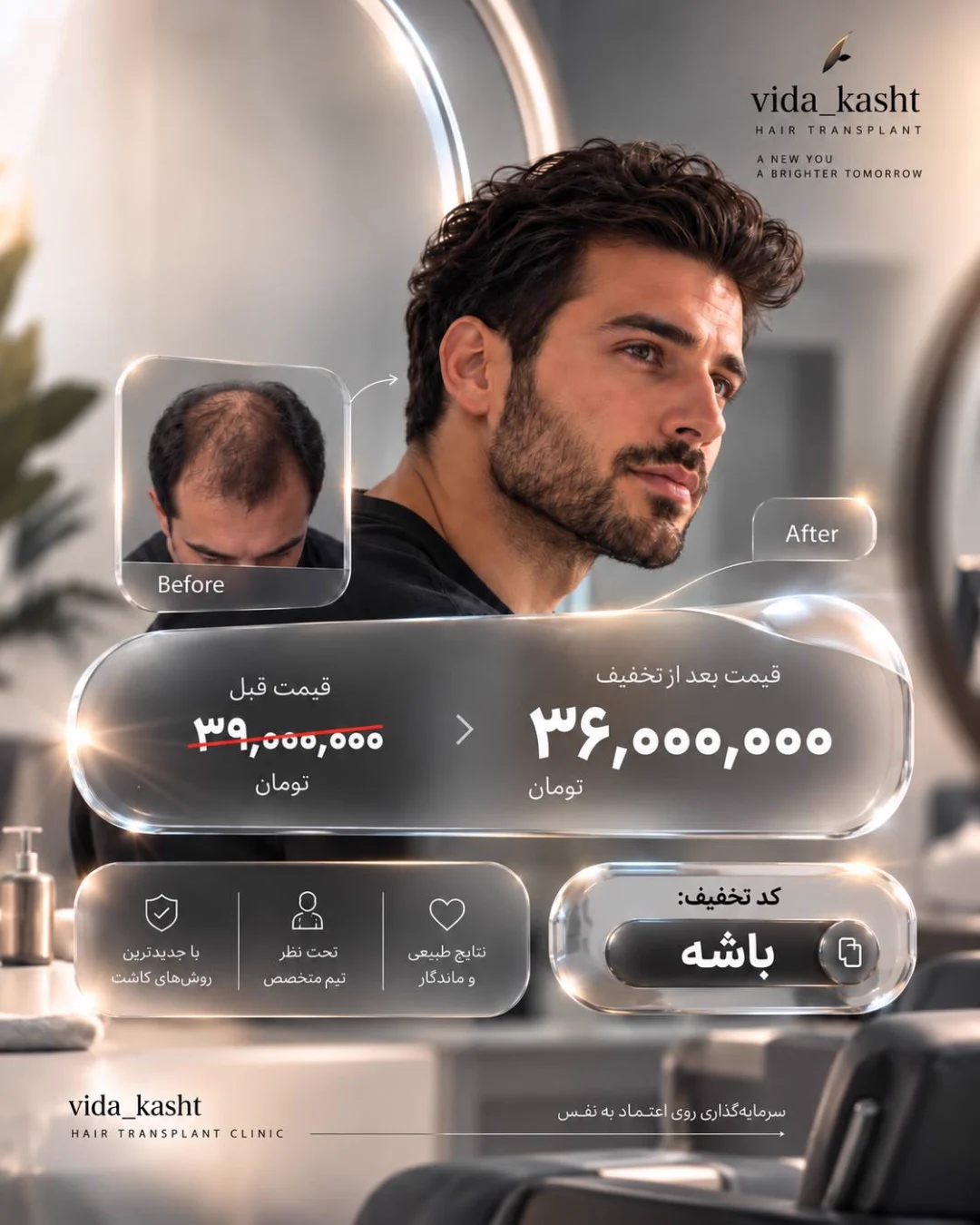 تخفیف کاشت مو — کاشت مو